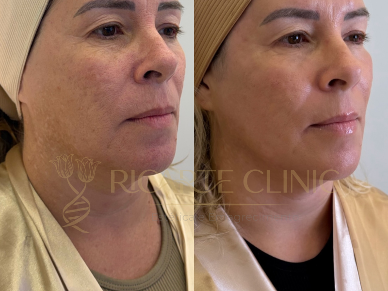 Ricarte Clinic