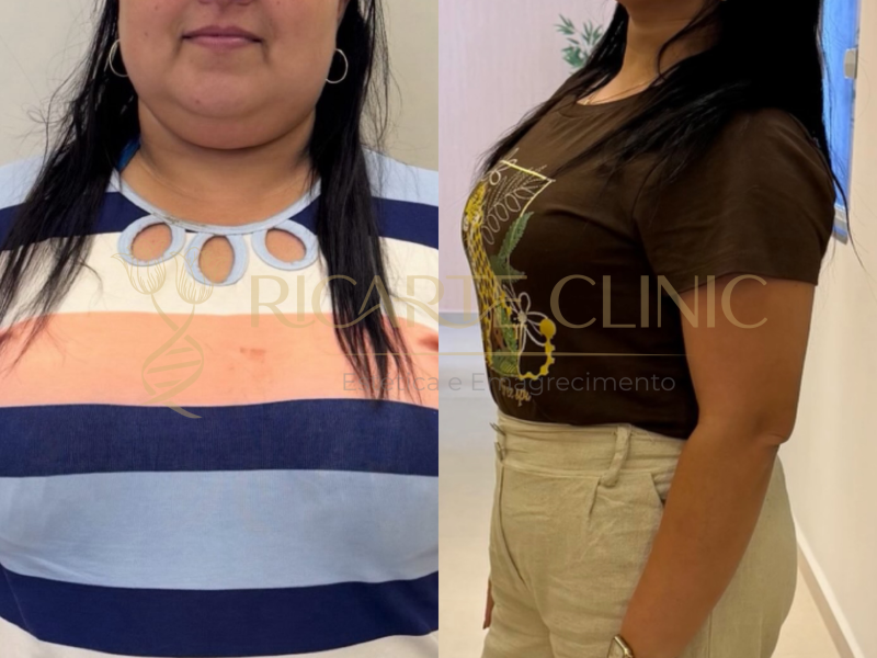 Ricarte Clinic Emagrecimento