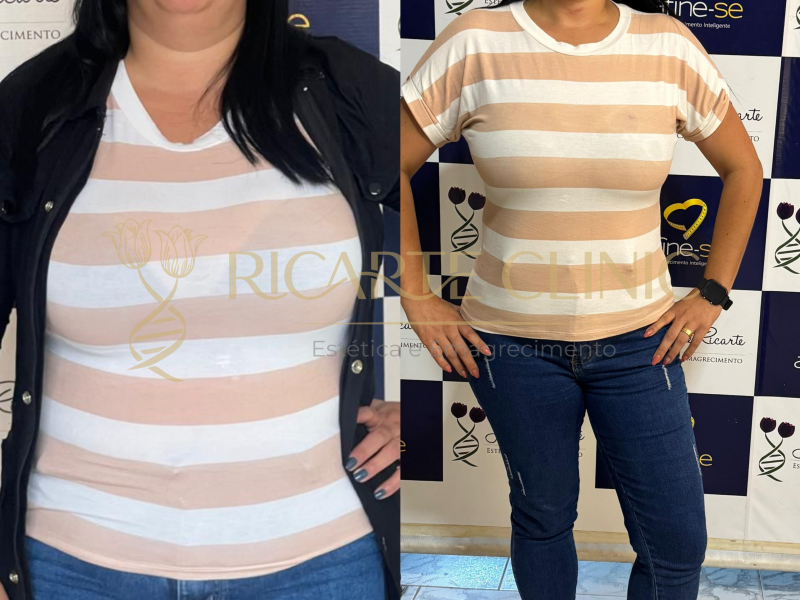 Ricarte Clinic Emagrecimento