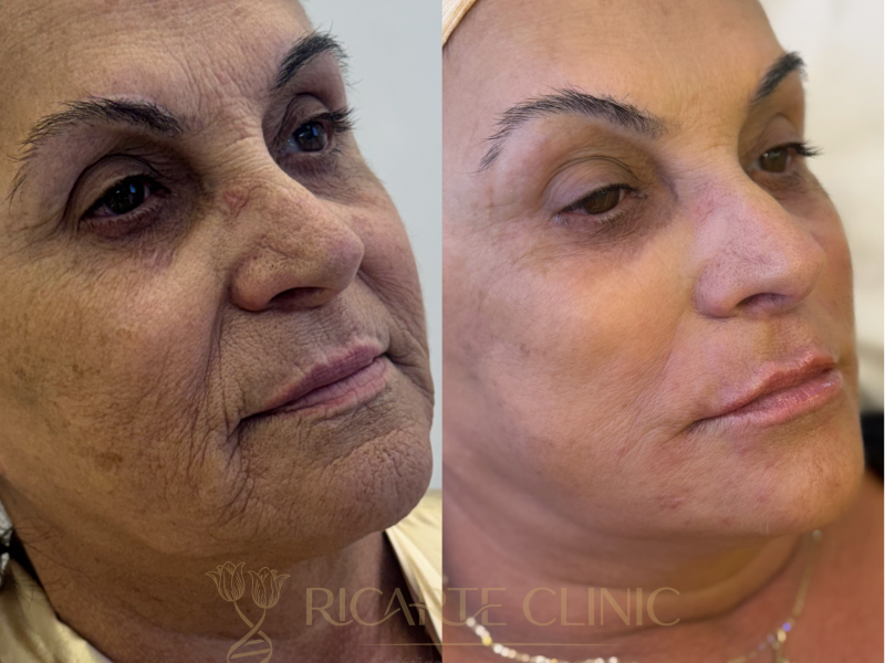 Ricarte Clinic