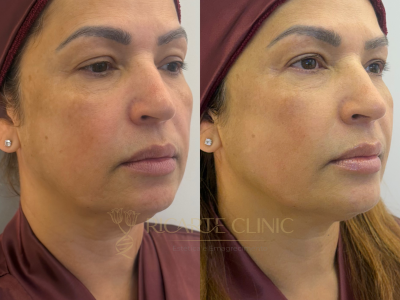 Ricarte Clinic